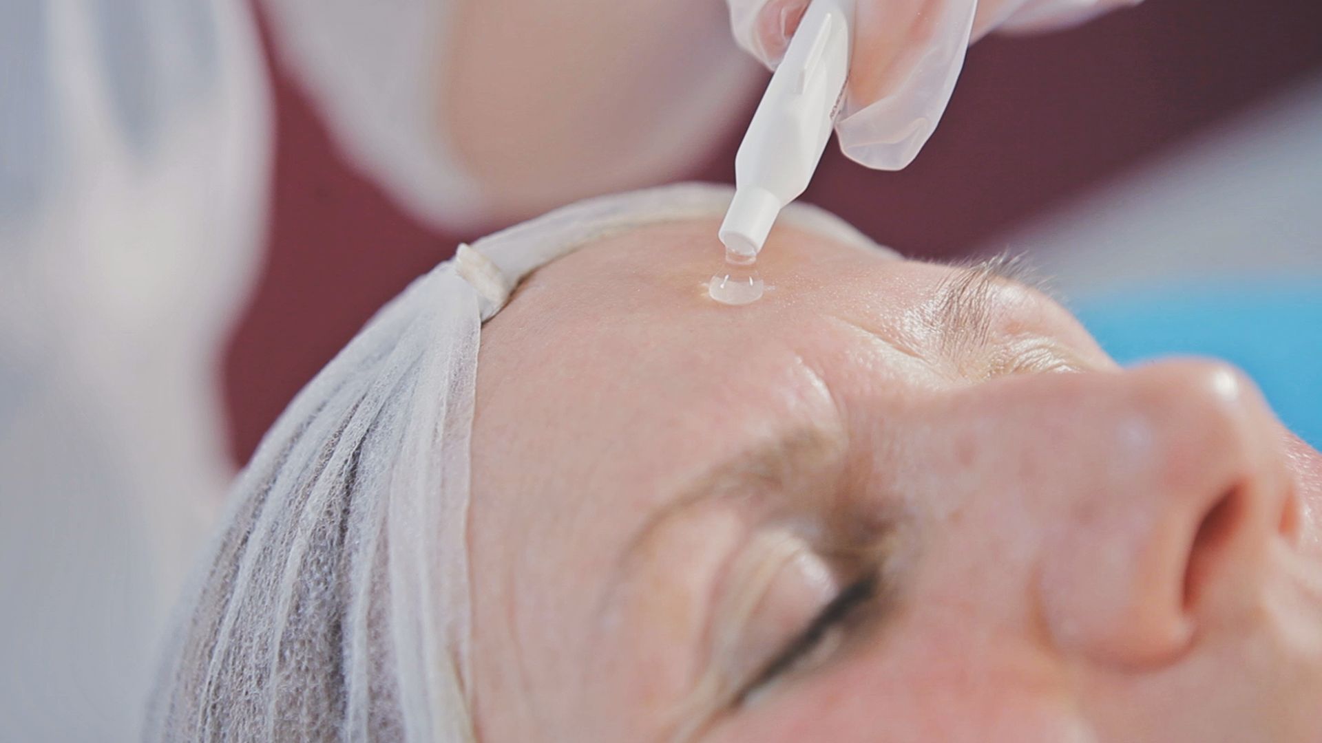Reviderm rosacea 3