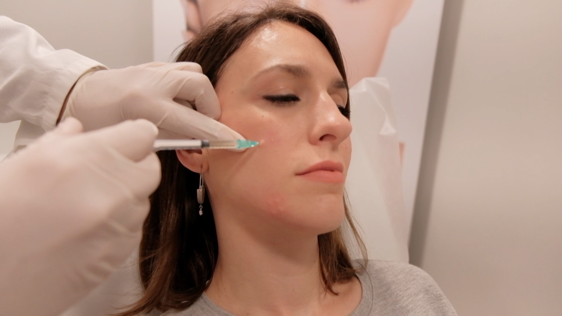 Plexr Mesoestetic Dudukovic 2