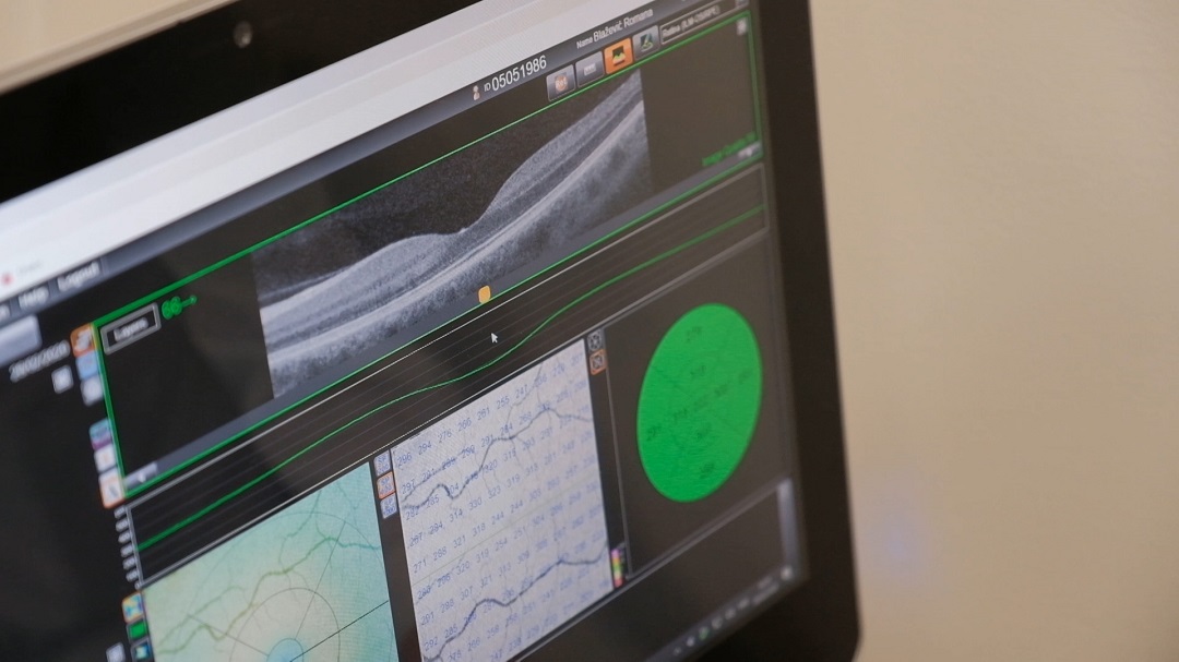 Ocna poliklinika dr. Vukas 2020. glaukom i laserska korekcija dioptrije 2