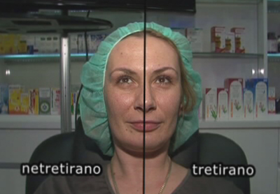 Poliklinika Poliderma - Mezoniti 3