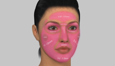 Dermapen 2