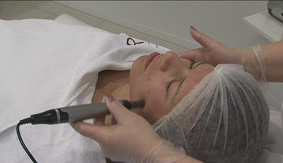Dermapen 8